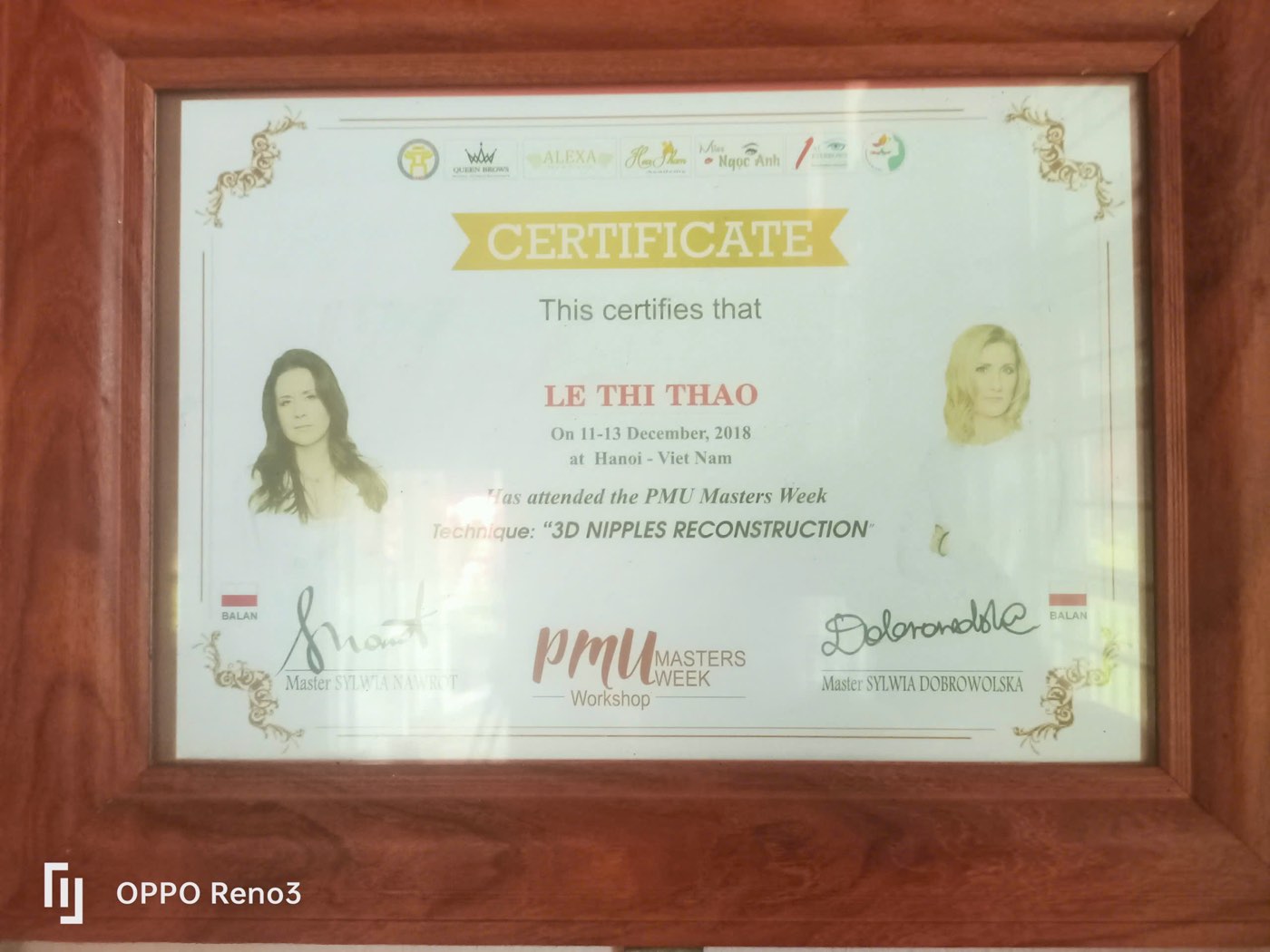 PMU Masters Week 2018 — Kỹ thuật tái tạo quầng vú 3D (phục hồi sau phẫu thuật)